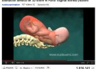 Animación Médica de 3D sobre el Parto Vaginal Normal | Recurso educativo 43271
