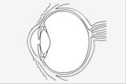 Cirugía láser para los ojos | Recurso educativo 45736