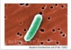 Escherichia coli | Recurso educativo 53571