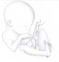 Operación prenatal a un bebé sin diafragma | Recurso educativo 54923