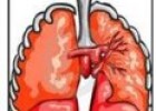 Cáncer de pulmón | Recurso educativo 76244